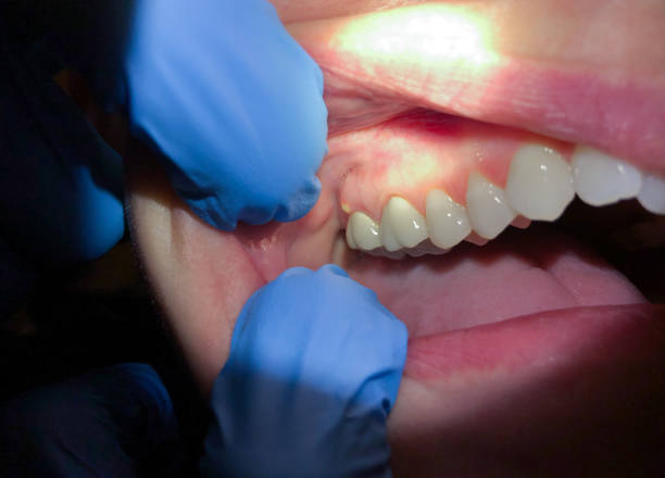Professional Emergency Dental Service in CO